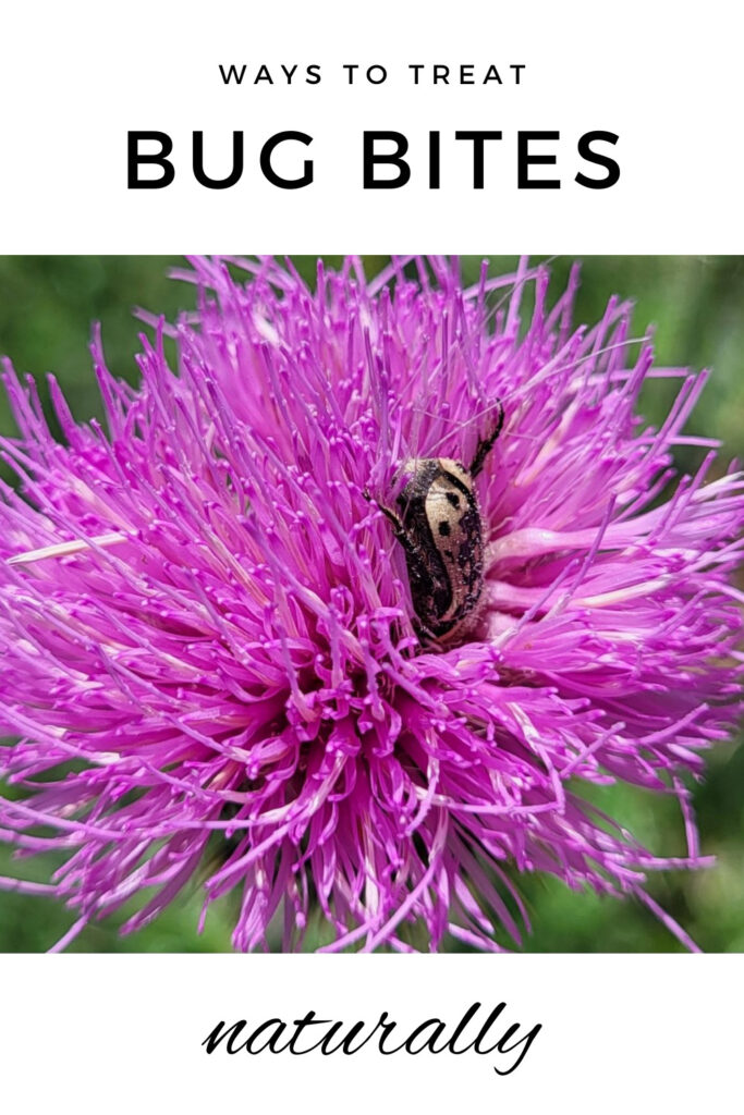 Ways To Treat Bug Bites Naturally